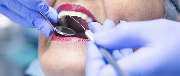 Best Emergency Dentist for Lost Fillings or Crowns in East Village, CT